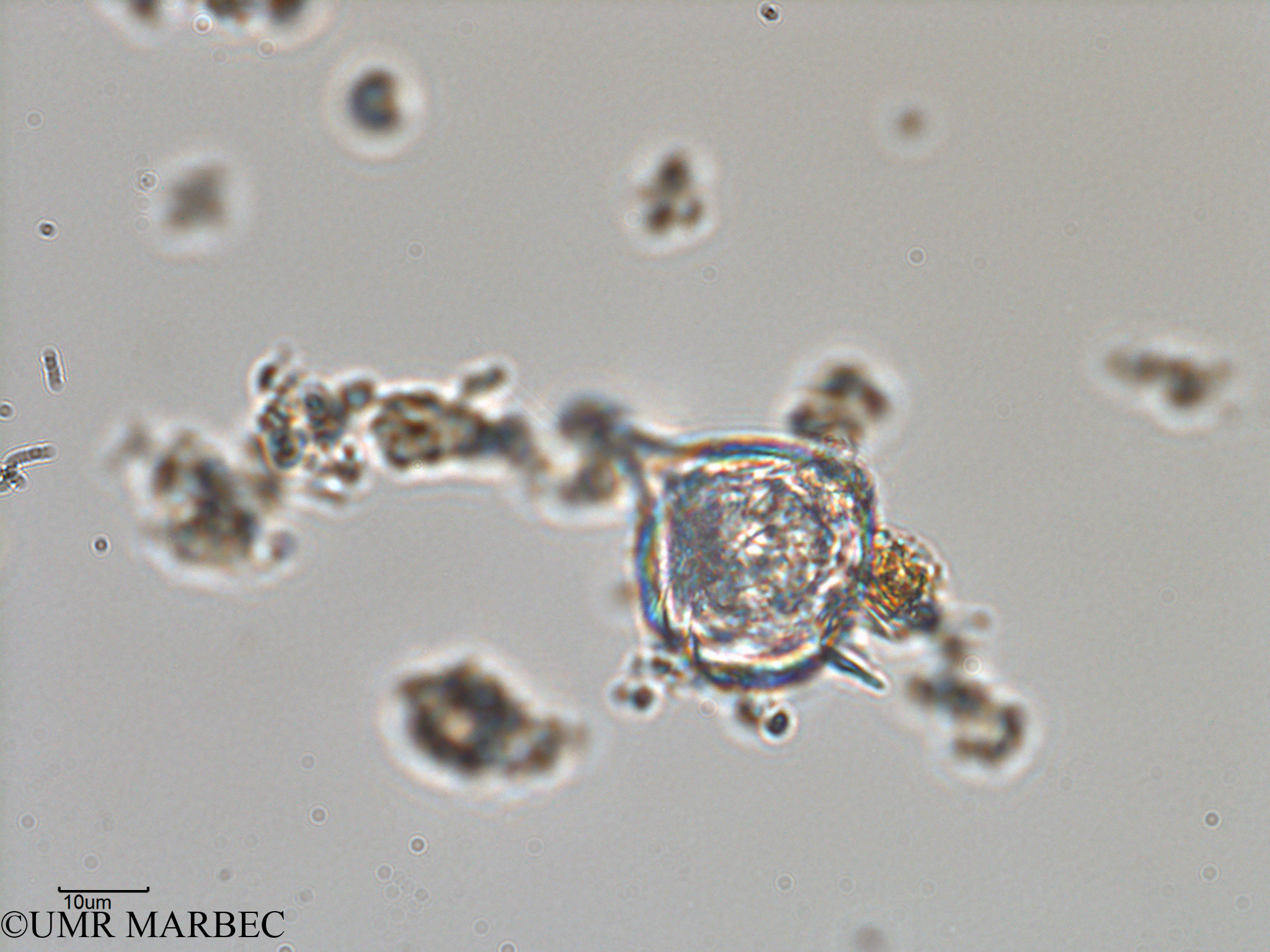 phyto/Bizerte/bizerte_lagoon/RISCO February 2015/Protoperidinium sp31 (ancien Lagune_T1-C-Protoperidinium sp31 -3).tif(copy).jpg